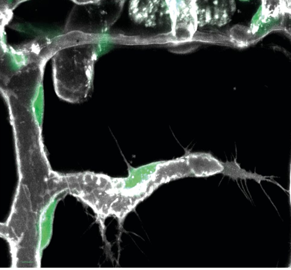 Blood vessels