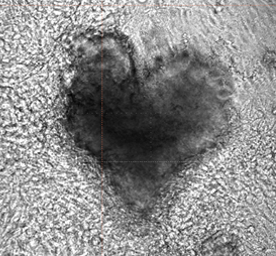 Heart Organoid