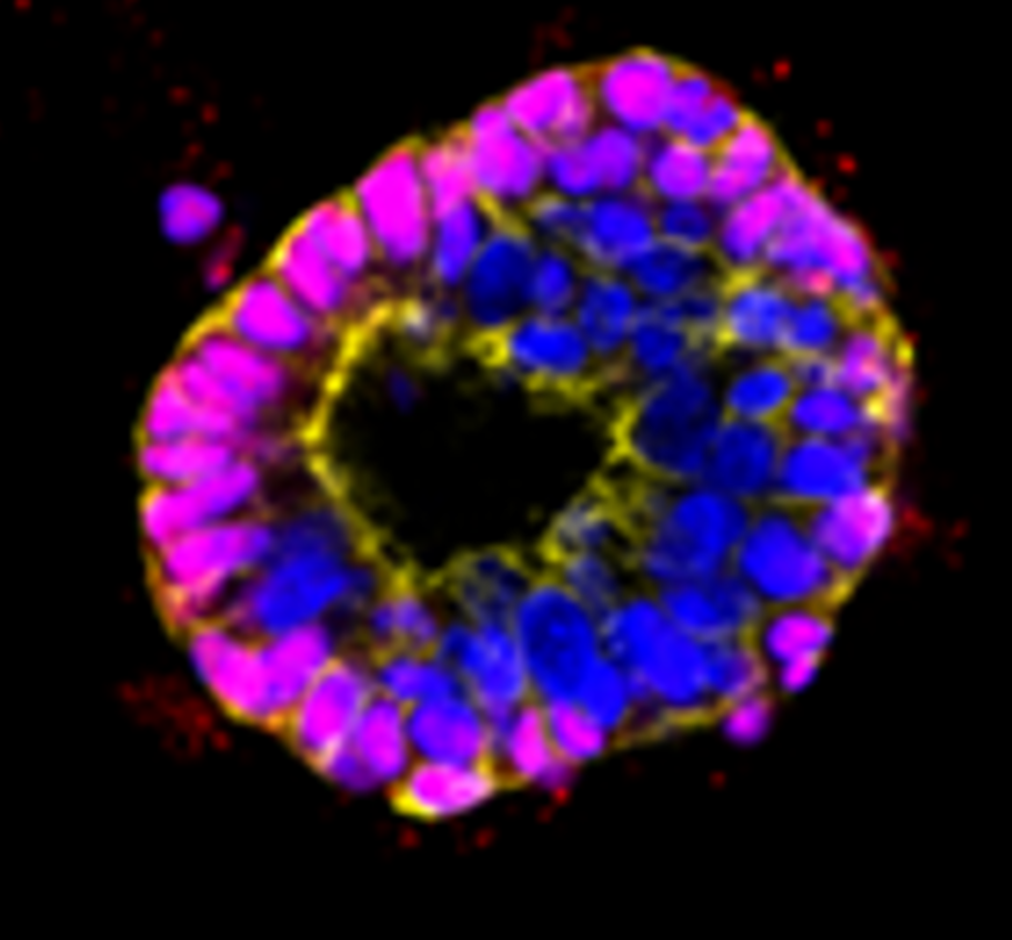 Intestinal Organoid 