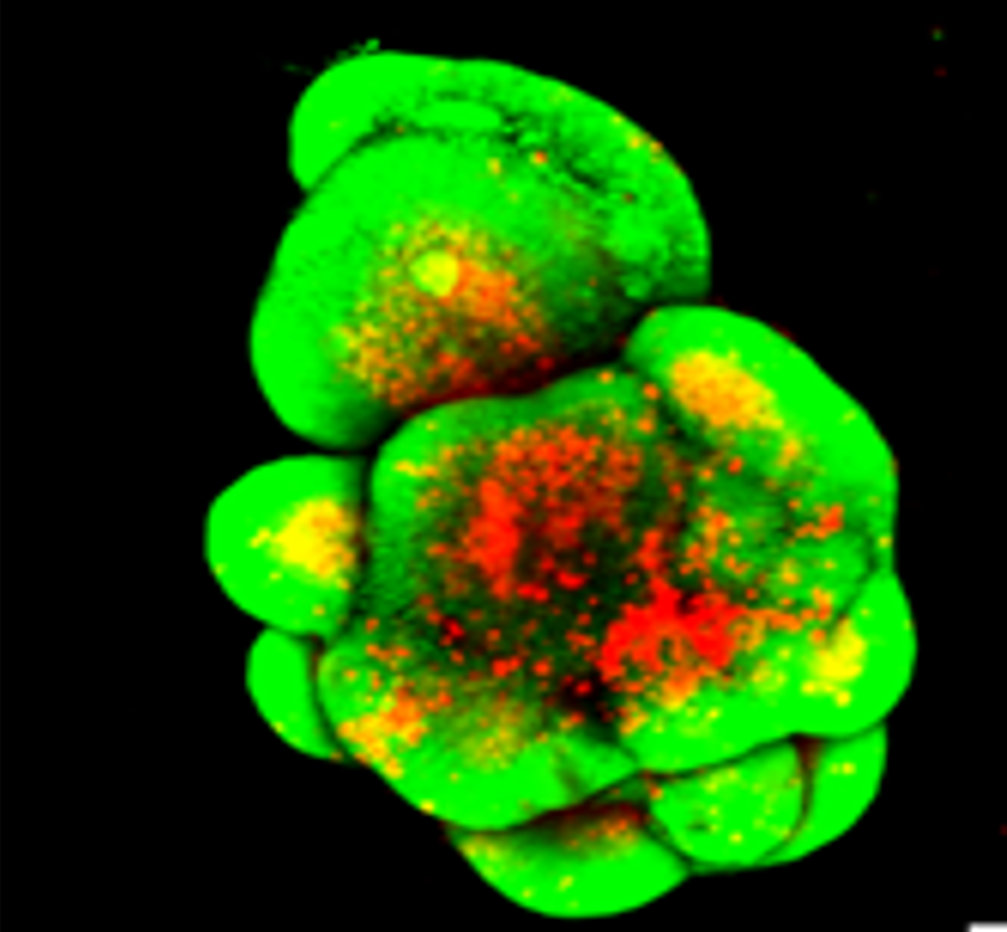 Retinal Organoid